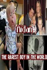 Watch Aidan The Rarest Boy In The World Soap2day