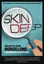 Watch Skin Deep: The Battle Over Morgellons Soap2day