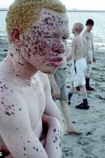 Watch Albino United Soap2day