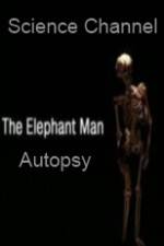 Watch Science Channel Elephant Man Autopsy Soap2day