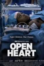 Watch Open Heart Soap2day
