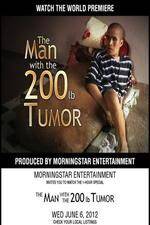 Watch The Man With The 200lb Tumor Soap2day