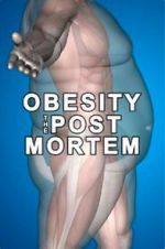 Watch Obesity: The Post Mortem Soap2day