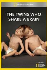 Watch National Geographic The Twins Who Share A Brain Soap2day