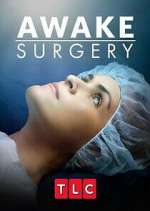 Watch Awake Surgery Soap2day