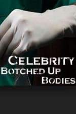 Watch Celebrity Botched Up Bodies Soap2day